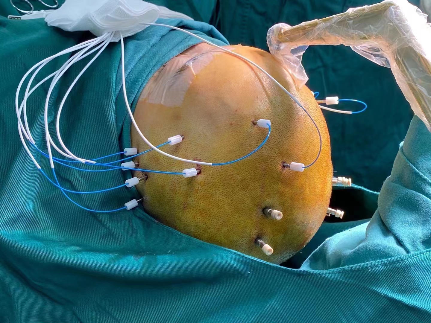 SEEG彩頁配圖2.jpg SEEG彩頁配圖2.jpg