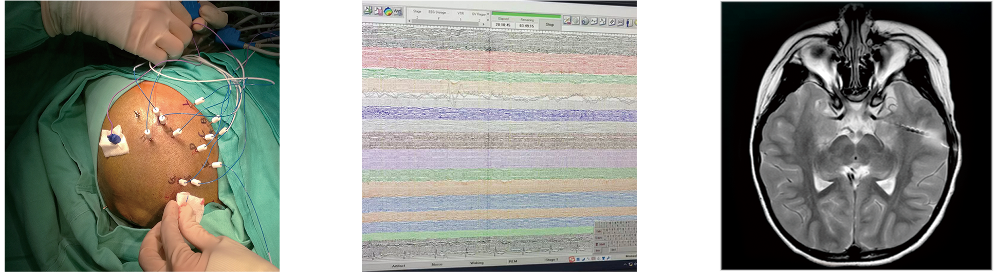 未標(biāo)題-1.png 未標(biāo)題-1.png